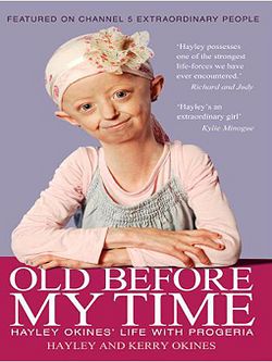 Progeria.jpg