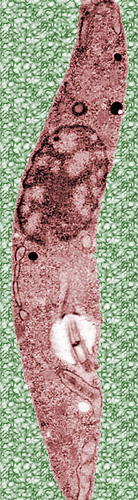 Trypanosoma. brucei.jpg