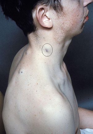BRNSCase-36.jpg