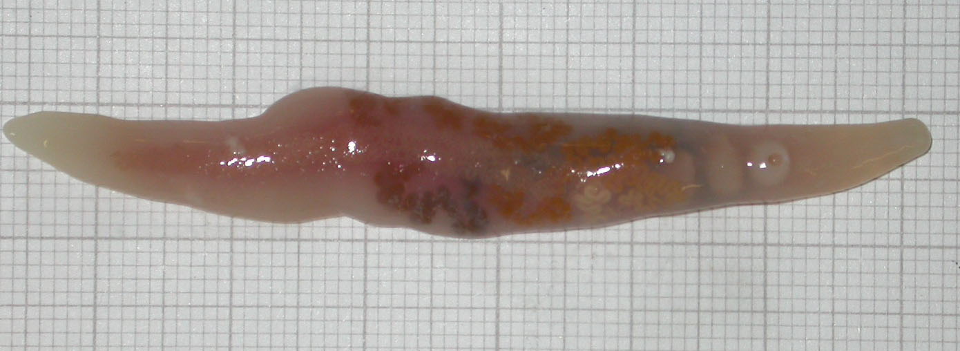 Botulus microporus, a giant digenean parasite from the intestine of a lancetfish