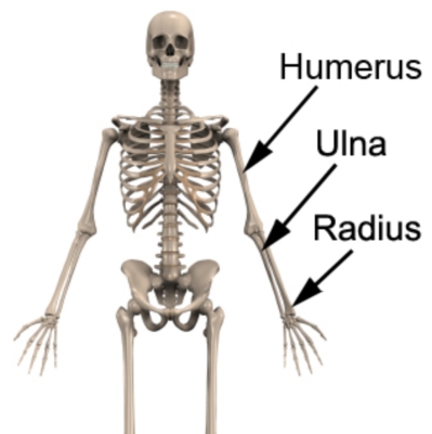 Fracture Ulnar.jpg