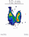 Fig. 4 Cold nodules