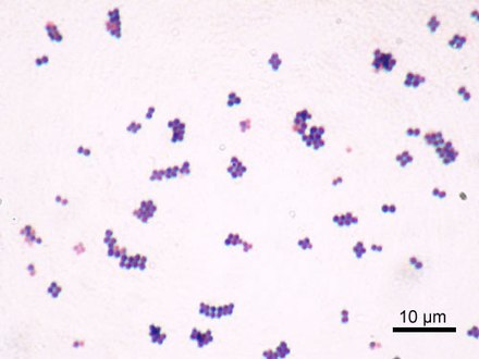 Gram stain of S. saprophyticus cells, which typically occur in clusters: The cell wall readily absorbs the crystal violet stain.