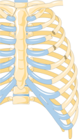 Illustration showing rib fracture at 3rd, 4th and 5th rib.