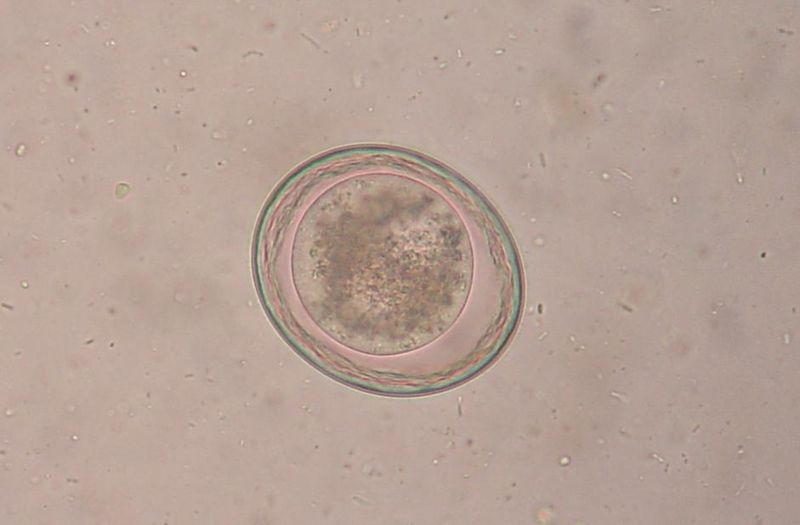 File:Roundworm egg.jpg