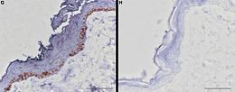 Skin biopsies stained blue. The one at left, from a non-white horse, shows much more blue staining and contains a layer of melanocytes. The melanocytes can be identified by the presence of brown pigment granules.